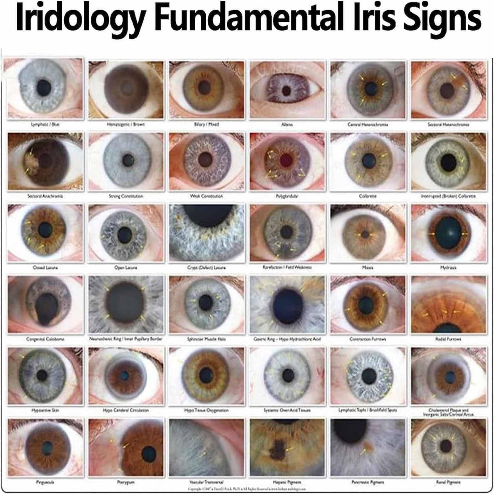 PixCy Cámara De Análisis De Iris, Iriscopio De Cámara Ocular USB De 12 MP con Lente De Iris De 30x Y Software De Análisis, Cámara De Iridología Ocular,Detector De Iris Portátil