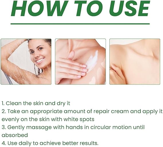 Vitiligo Fix Revitalize Elixir,Vitiligo Treatment Cream,Natural Treat Vitiligo Soothing Cream,Moisturizer Cream for Skin Vitiligo,Body Vitiligo Care Cream For Reduce White Spot (2PC)