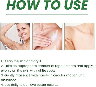 Vitiligo Fix Revitalize Elixir,Vitiligo Treatment Cream,Natural Treat Vitiligo Soothing Cream,Moisturizer Cream for Skin Vitiligo,Body Vitiligo Care Cream For Reduce White Spot (2PC)