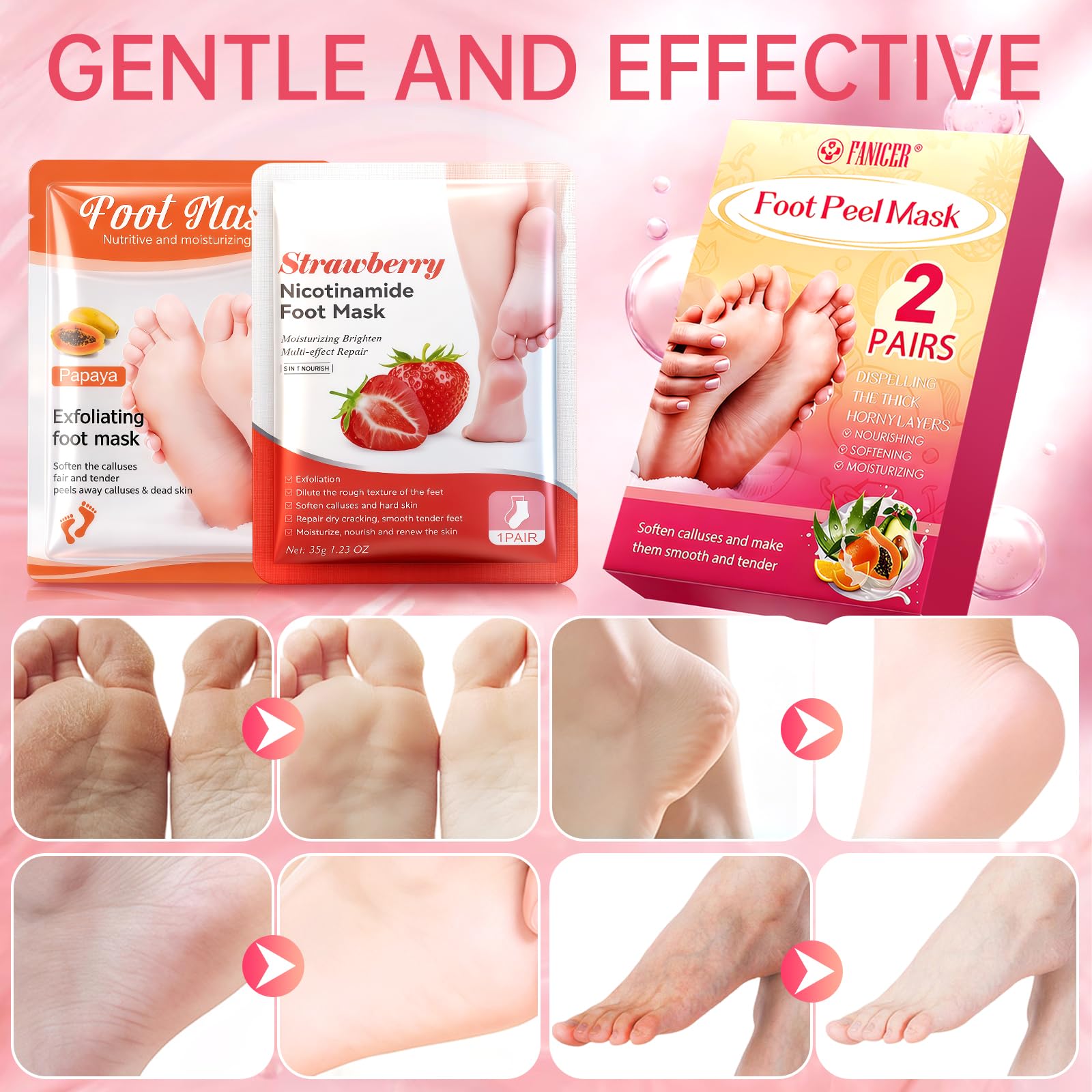 2 Paires Masque Pied Exfoliant，Masques Nourrissant pour les Pieds, Chaussette Exfoliante Pieds très Secs et Abîmés, Hydratation Profonde, pour Femmes & Hommes (Fraise+ Papaye)
