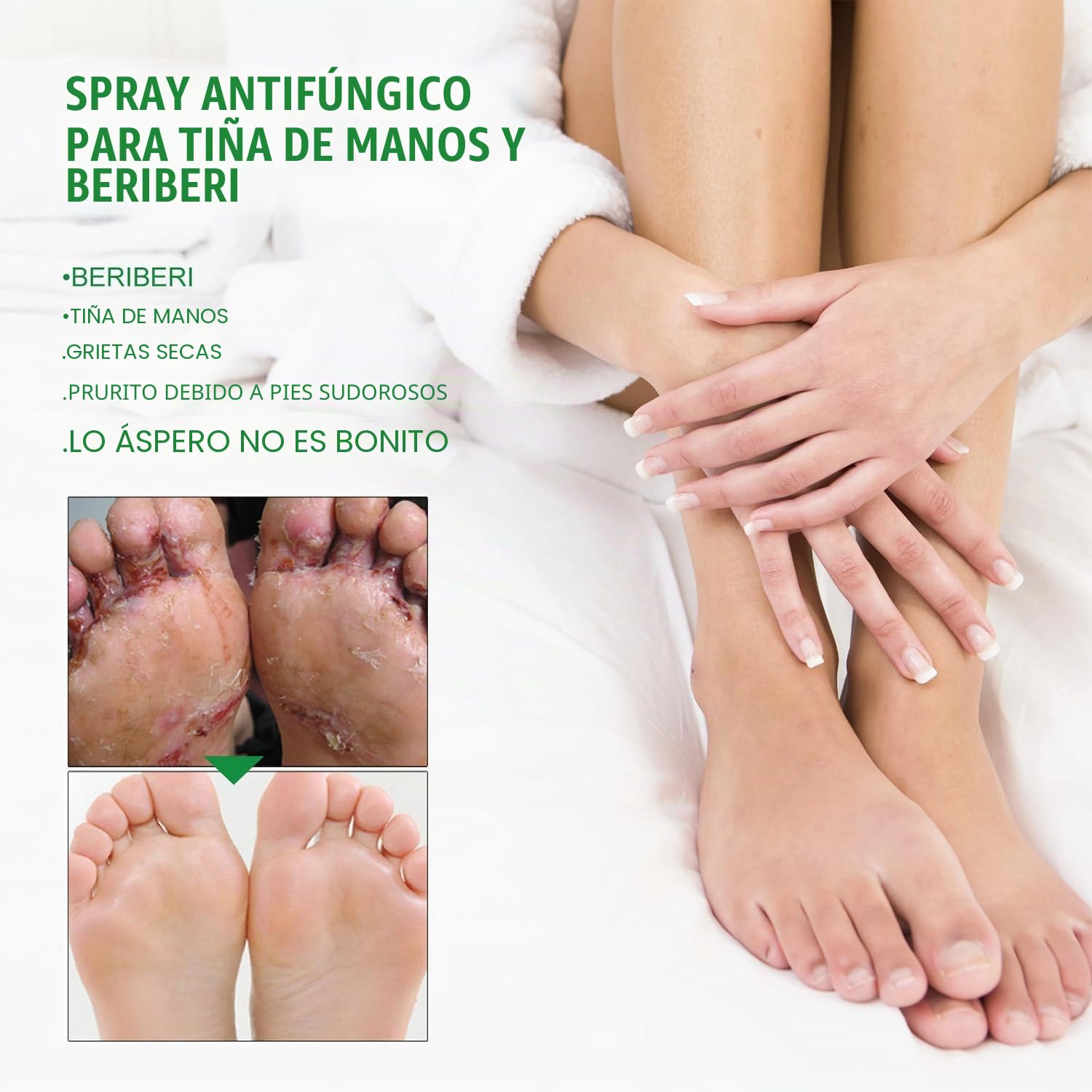 Spray para Pies, Spray para Pie de Atleta, Spray para el cuidado de los pies, Hidratante y reparador, Mujeres y Hombres Adultos, 30ml