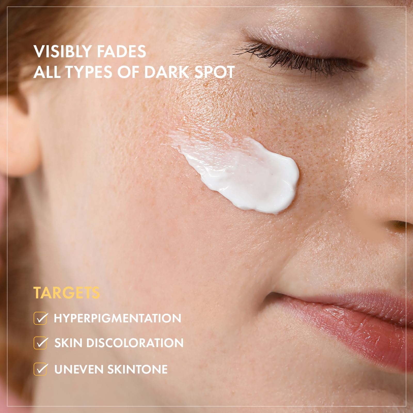 TOSOWOONG 8 Days Spot Cream, Dark Spot Remover for Face Age Spot, Sun Spot, Freckles, Melasma, Brown Spot Serum - Image 4