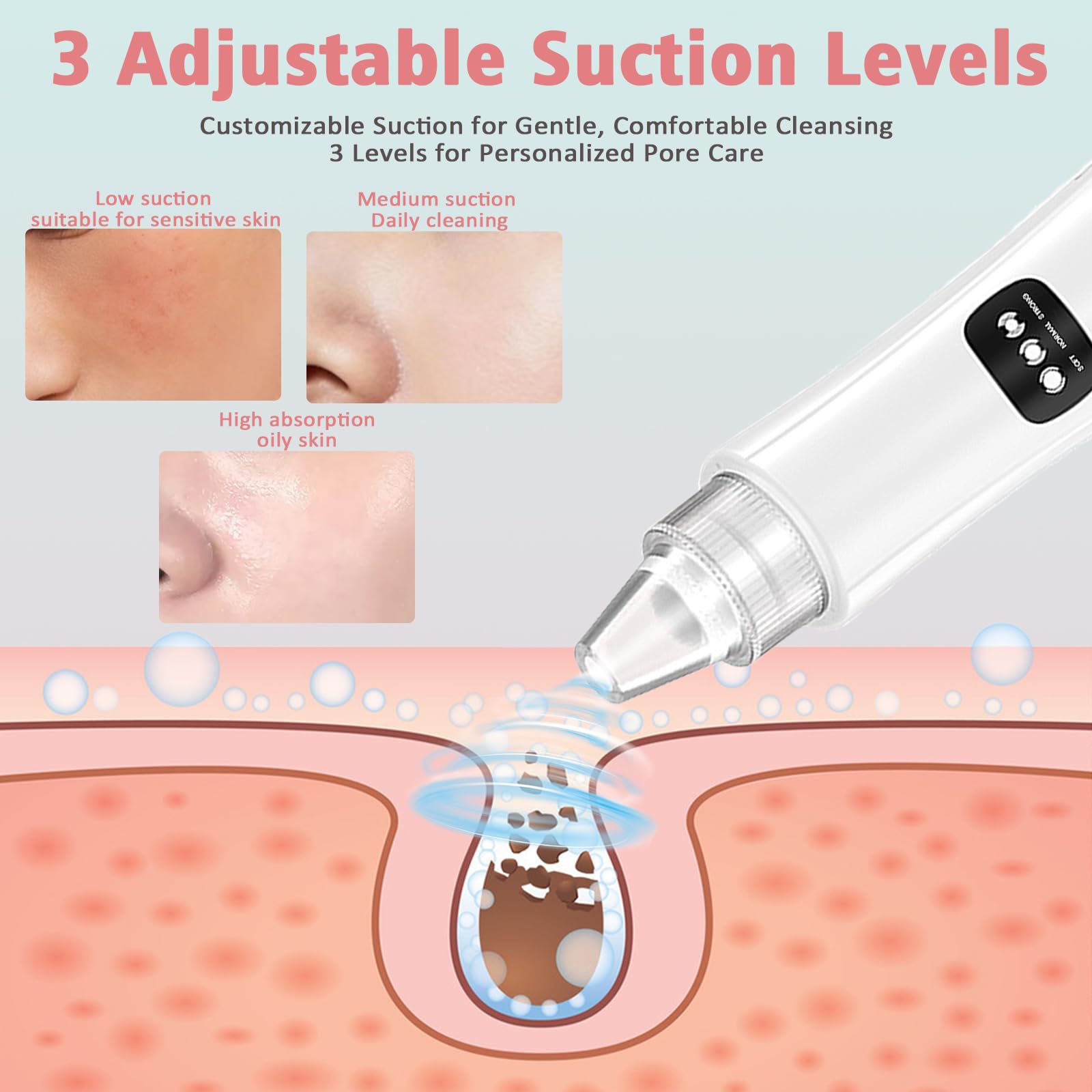 Aspirapolvere per punti neri, estrattore di punti neri, 5 potenza di aspirazione 3 aspirazione regolabile, kit per la pulizia dei pori del viso ricaricabile tramite USB, strumento elettrico per donne