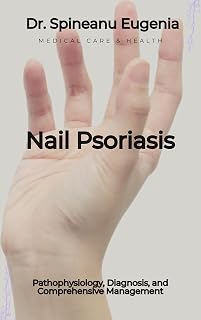 Nail Psoriasis: Pathophysiology, Diagnosis, and Comprehensive Management