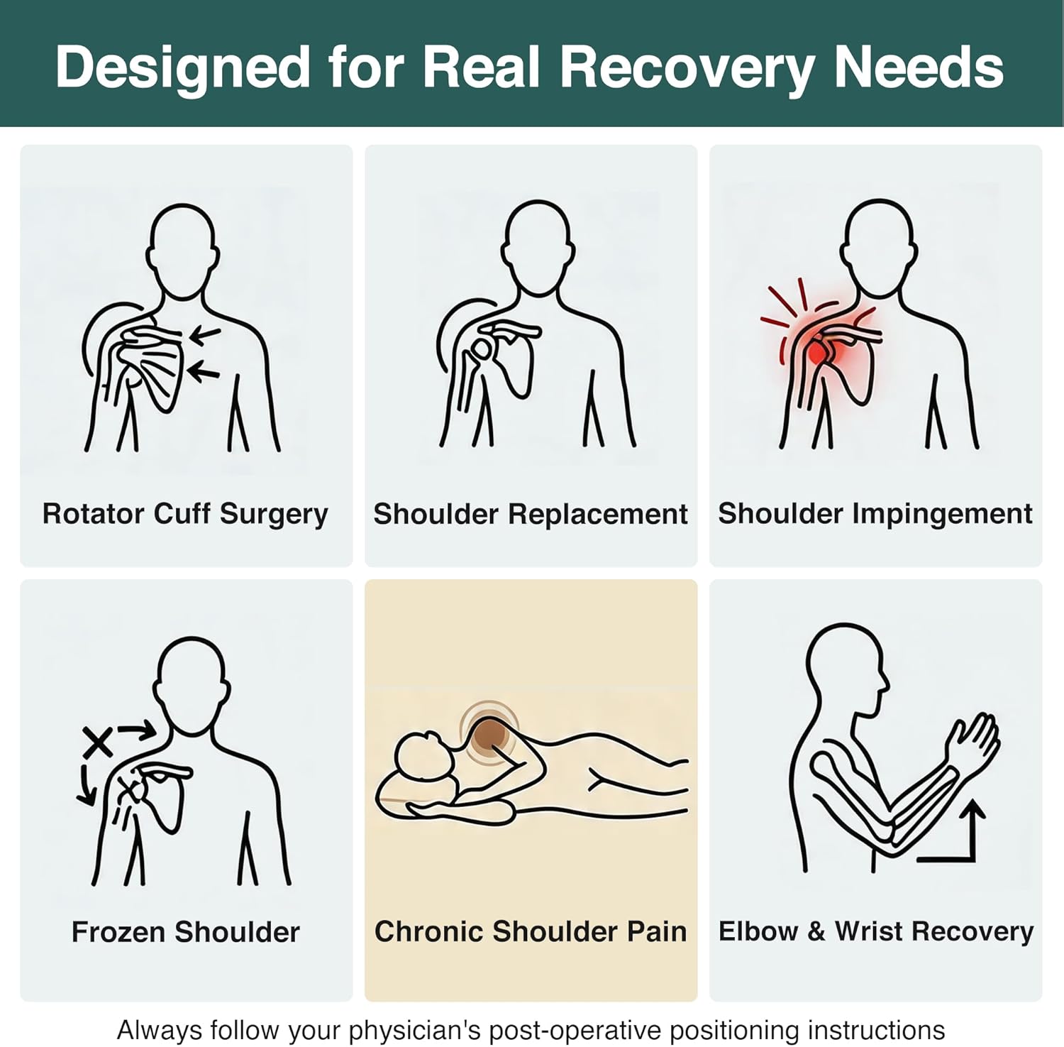 Shoulder Surgery Pillow for Sleeping, Arm Elevation Pillow for Rotator Cuff Recovery, After Shoulder Surgery Supplies, Side Sleeper Cushion for Pain Relief, Broken Arm Post Surgery Must Haves