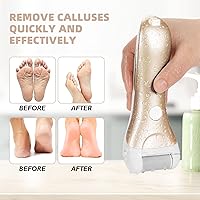 Vista 6 de Callus Remover for Feet, Nicebirdie Electric Foot File Callus Removers Rechargeable Waterproof Pedicure Tools Foot Scrubber Shaver Feet Care Tool