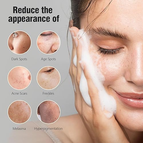 Miniatura 4 de Jabón de ácido kójico para manchas oscuras de hiperpigmentación, barra de jabón de cúrcuma para iluminar la piel con aceite de árbol de té, manteca