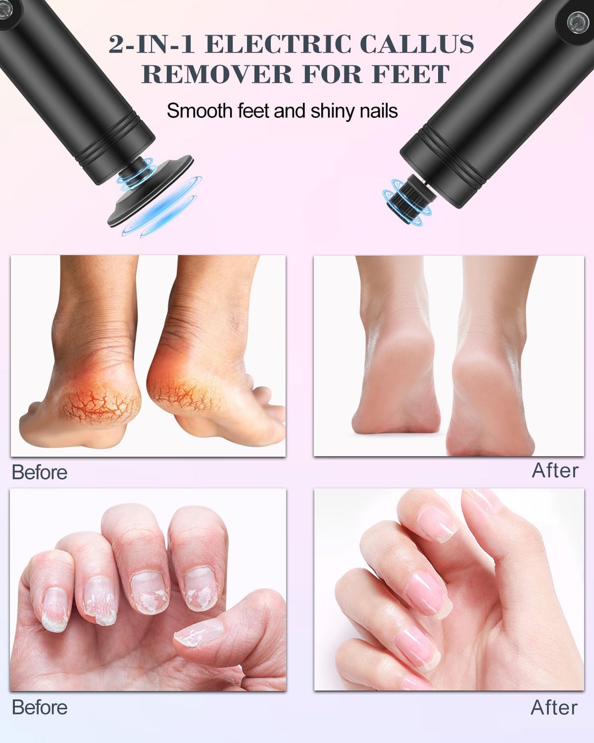 2-in-1 hornhautentferner elektrisch mit 9 Einstellbaren Geschwindigkeiten Wiederaufladbare LED Pediküre und Maniküre Set mit Auswechselbare Schleifscheiben für Fuß & Nagelpflege