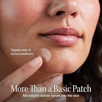 Solawave Bye Acne Microdart Patches (9 Count) | Hydrocolloid Patch for Pimples, Acne, Blemishes | Spot Treatment for Face |