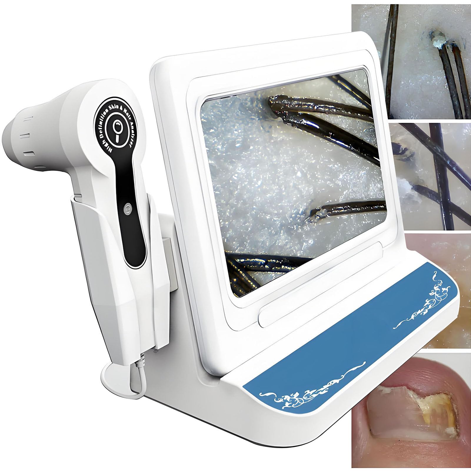 SHENGSHIYU Scalp Analyzer,Scalp Treatment Equipment with Carry Case,50/200x Switchable Dual Lens,One-Click Capture,Hair Test,Follicle Detection,10mp HD Imaging,Rechargeable & Plug-In Dual Power