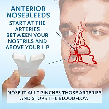 その他 The Nosebleeds Amazon.com: Nose It All - Nosebleed Stopper Family Pack