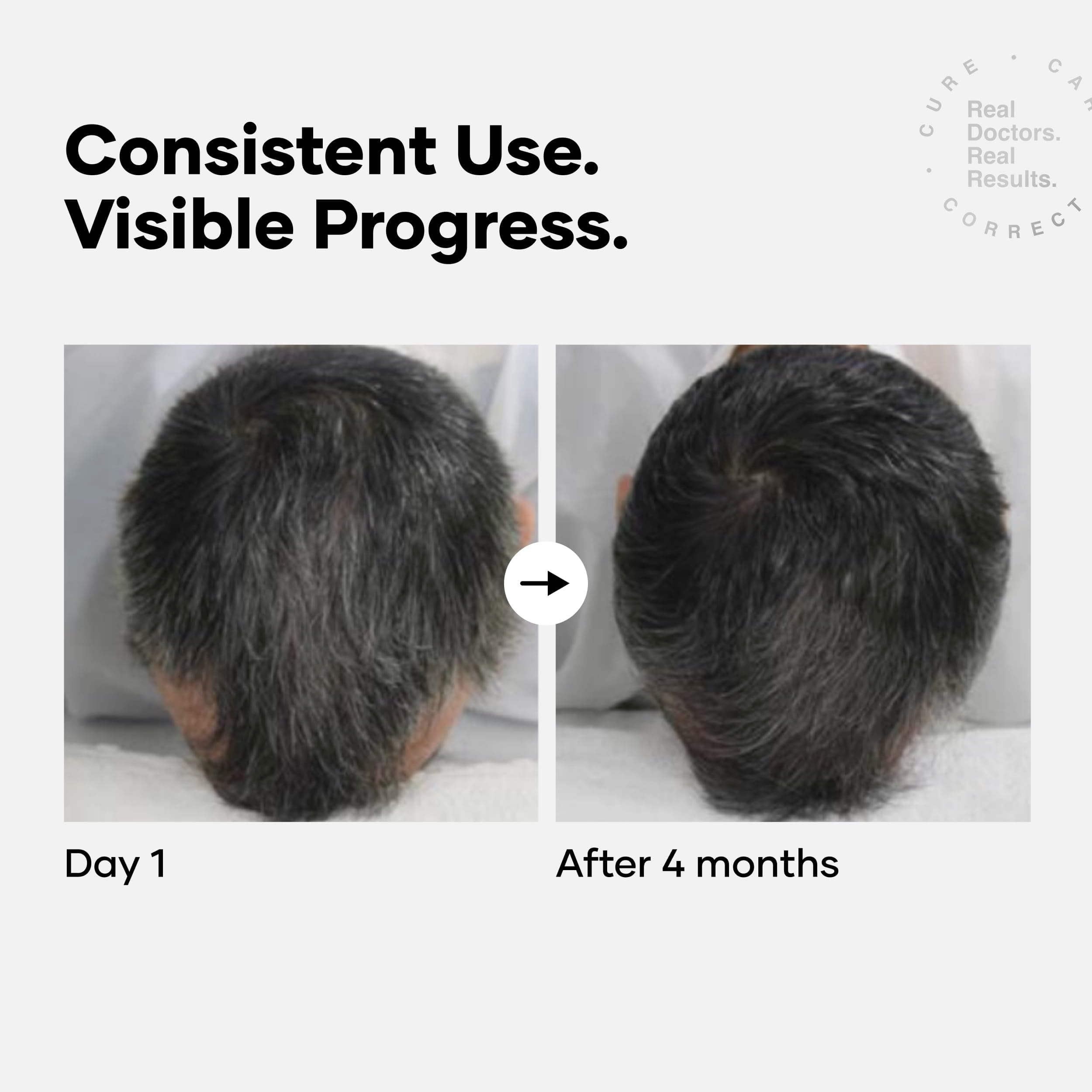 Cureskin Dark Pro Hair Solution Sérum Anti-Cheveux Gris 60 ml Lot de 2