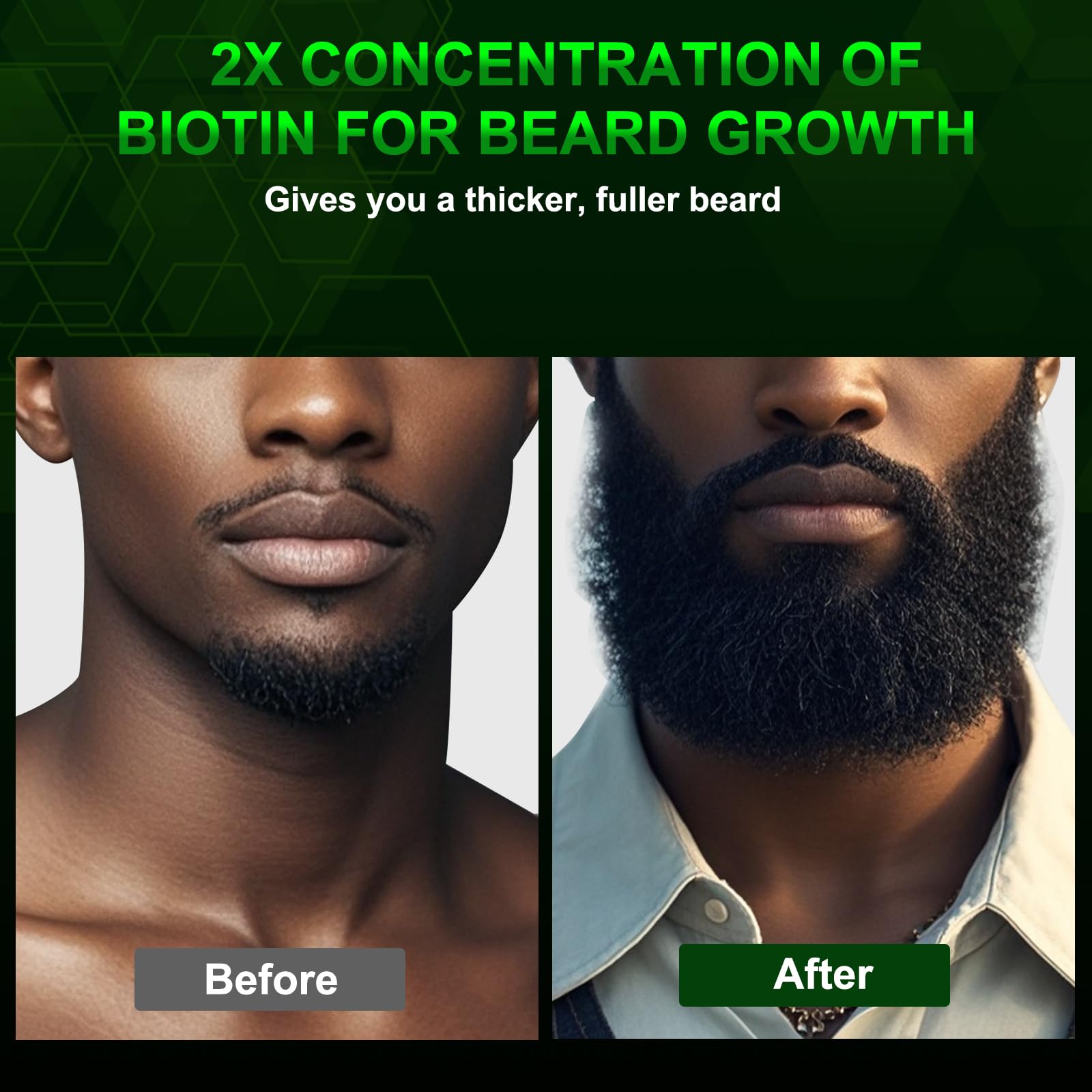 Condition photo showing New/Like New for Beard Oil and  for Men - Beard Growth Kit for Beard Soften and Moisture - Natural & Organic Jojoba, Argan, Shea Butter - Beard Care Kit for Dad, Husband, Boyfriend, Green