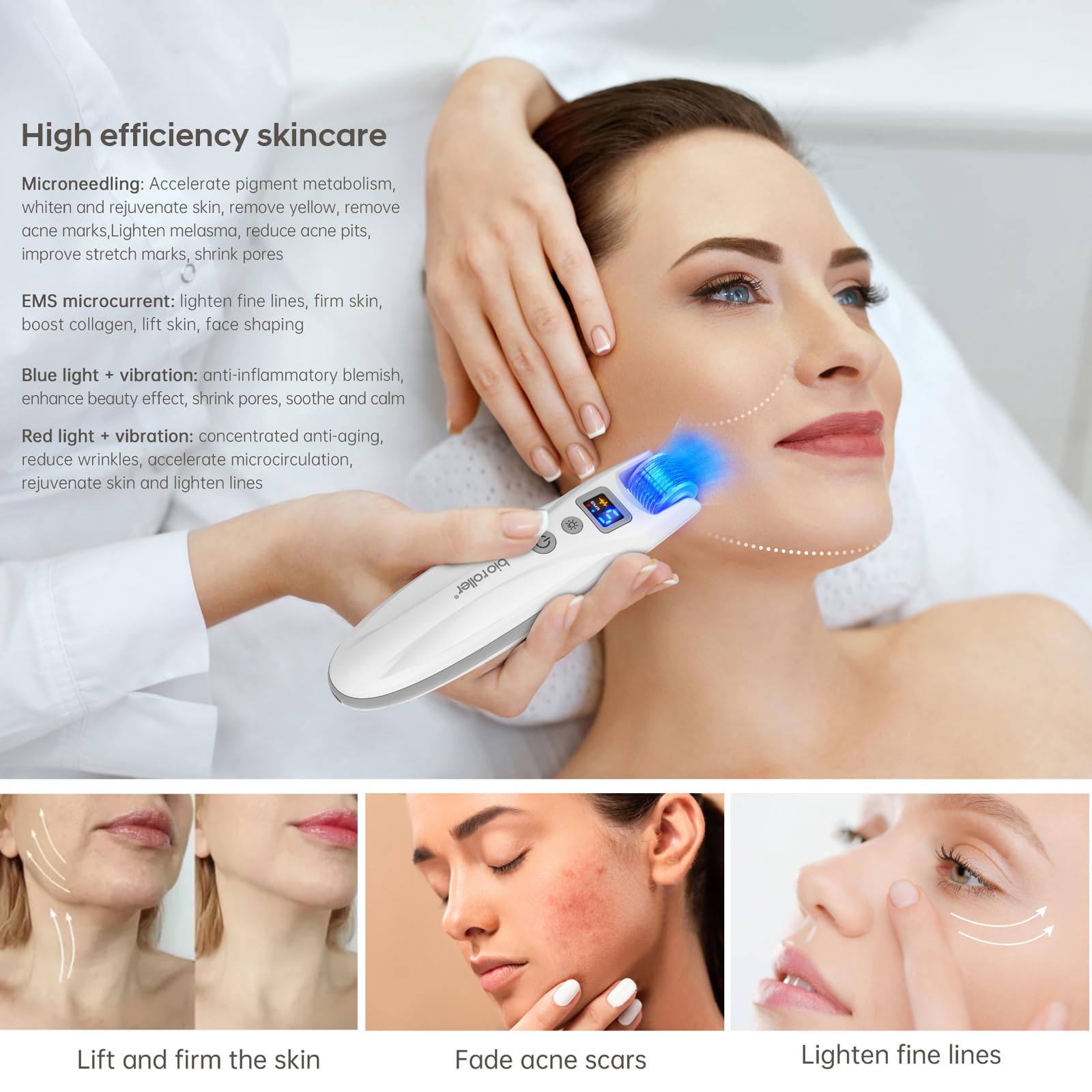 G5 Microneedling Roller Pen — Elektrisches Microneedling Set, 5 EMS Stufen & Rot Blau LED Vibration, geeignet für Gesicht, Körper, Haare & Bart – 2 Patronen