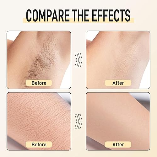 Miniatura 6 de Cyperus Rotundus Aceite para depilación, 1.06 onzas líquidas de aceite inhibidor del crecimiento natural del cabello con almendra dulce y aceite de