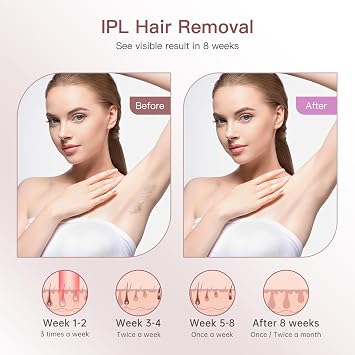 Laser Hair Removal Device, 999900 Flashes Hair Removal with Ice Cooling Function, 9 Level Painless Salon Quality at Home, Lazer Hair Removal for Women Bikini Line Armpit Leg Body, White | 5 Level Painless IPL Hair Removal Salon Quality at Home, Lazer Hair Removal for Women Bikini Line Armpit Leg Body