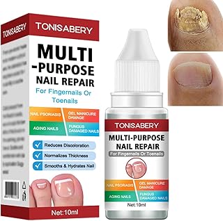 Fungal Nail Treatment,Nail Fungus Treatment for Toenail,Ingrown Toenail Treatment Toe Nail Fungal Treatment,Fungal Nail Treatment for Toenails Extra Strong,Nail Repair Treatment Repairing Broken Nail