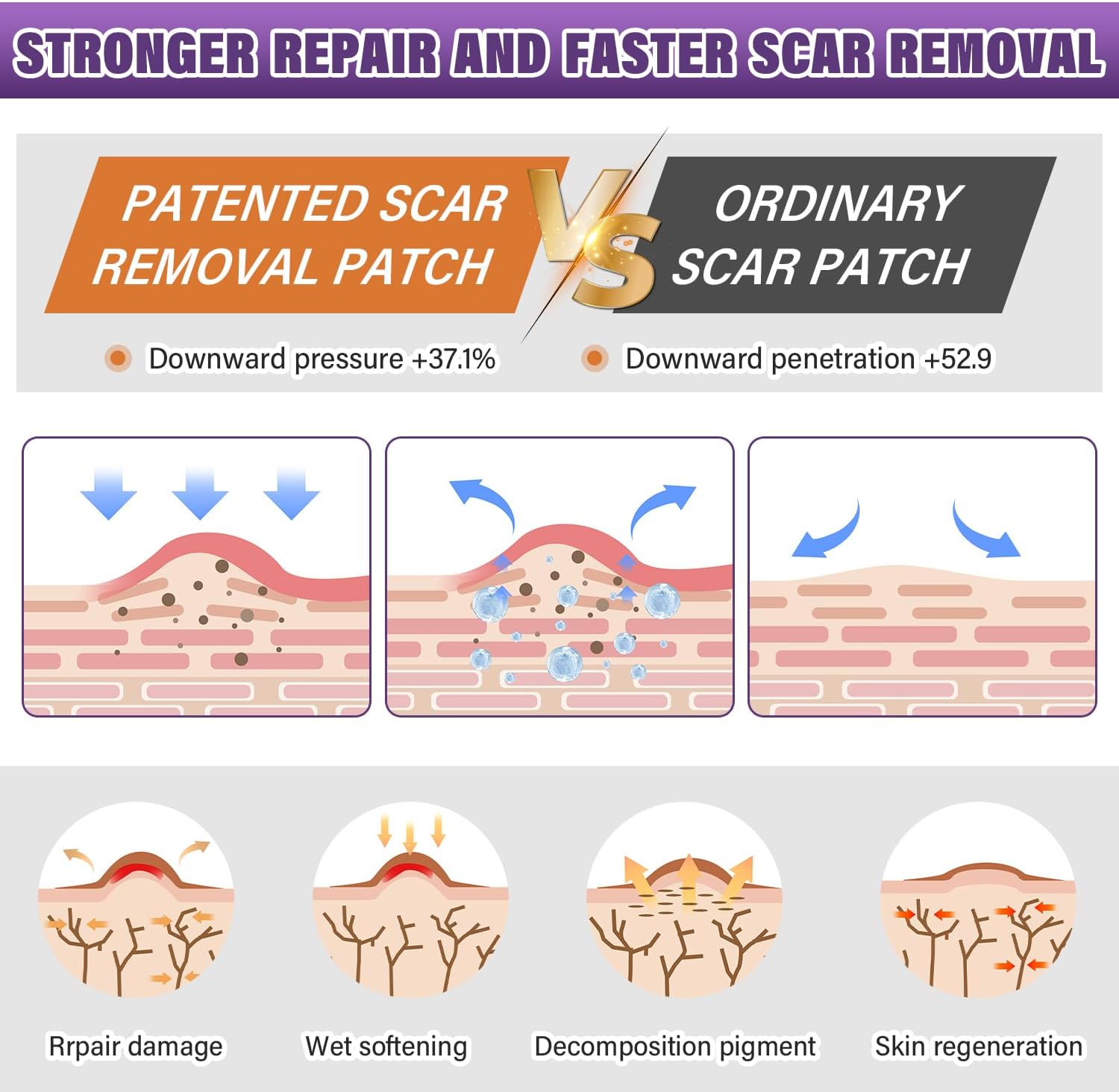 Silicone Scar Tape, Silicone Scar Sheets,Medical Grade Scar Tape (1.6‘ x 60’-1.5M) for C-Section, Surgery, Burn, Keloid, Acne - Reusable Surgical Silicone Scar Sheets - Image 3