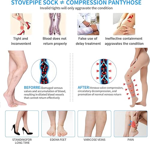 Miniatura 2 de 2 pares de medias de compresión de 20-30 mmHg con punta cerrada, opacas, graduadas, de apoyo para mujeres, alivia las venas varicosas Beige