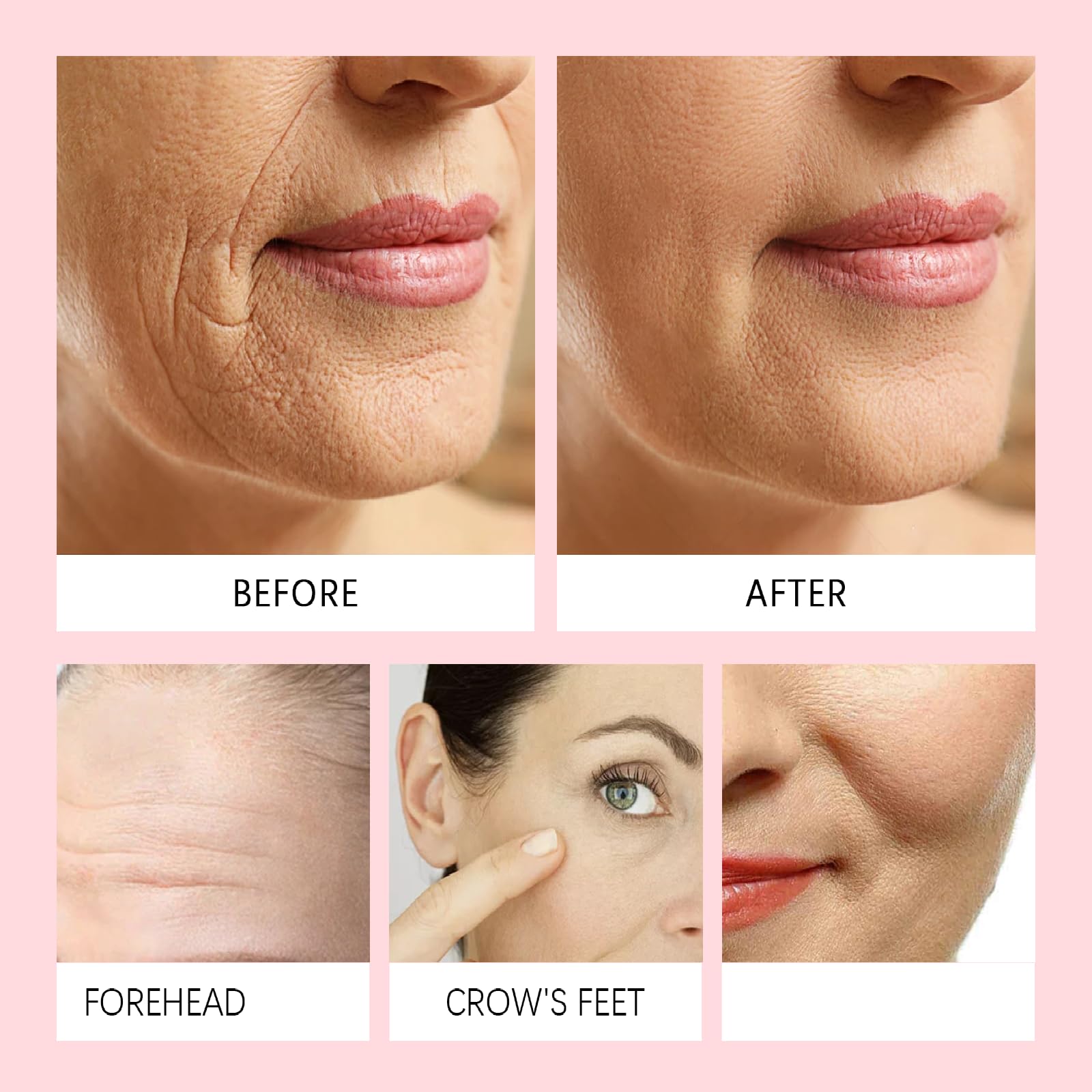 Siero viso anti-età 5 in 1, siero rassodante antirughe per migliorare l'elasticità della pelle, ridurre linee sottili e rughe, schiarire le macchie scure e idratare la pelle spenta (9PCS)