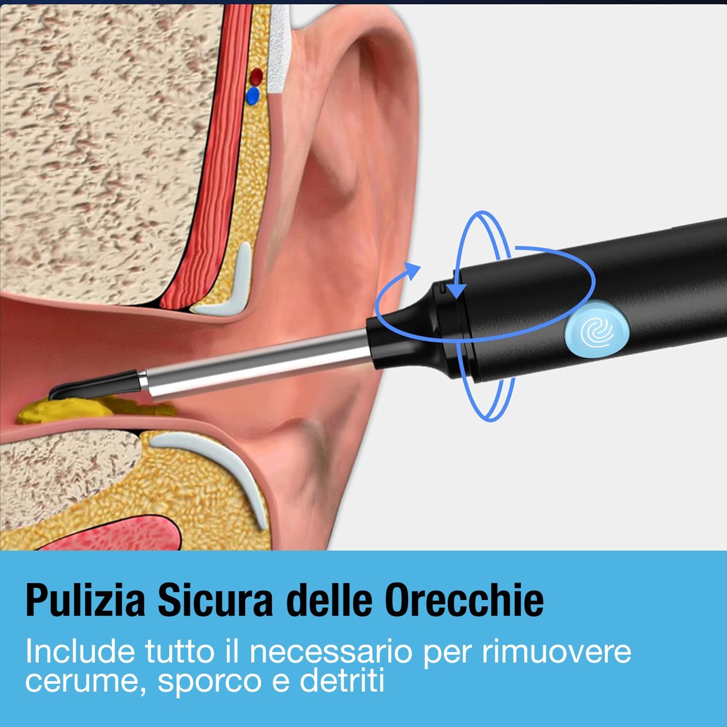 Tilcare Strumento per la Rimozione Cerume con Telecamera - Sistema per Irrigazione dell'Orecchio per Adulti e Bambini - Include Bacinella, Siringa, Kit Curette, Asciugamano e 30 Punte Monouso