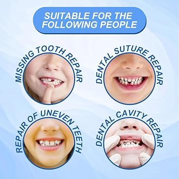 Temporary Tooth Filling Repair Kit with Moldable False Teeth - Replace Missing or Broken Teeth with Dental Repair Beads - Ideal for Fixing and Filling Teeth - Fake Teeth Replacement Kit