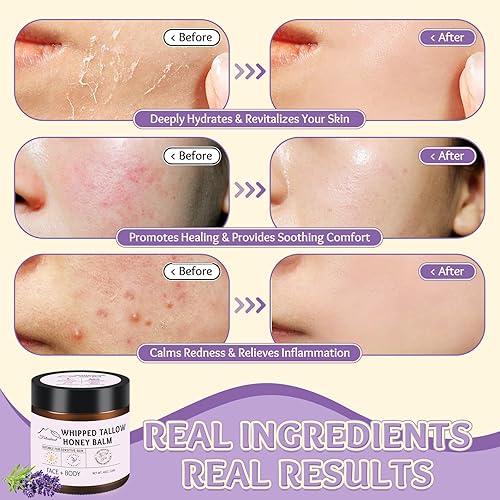 Miniatura 4 de Sargo de ternera para la piel, sargo y bálsamo de miel, 100% sarga de res natural para la cara, sargo de res orgánico alimentado con pasto y bálsamo