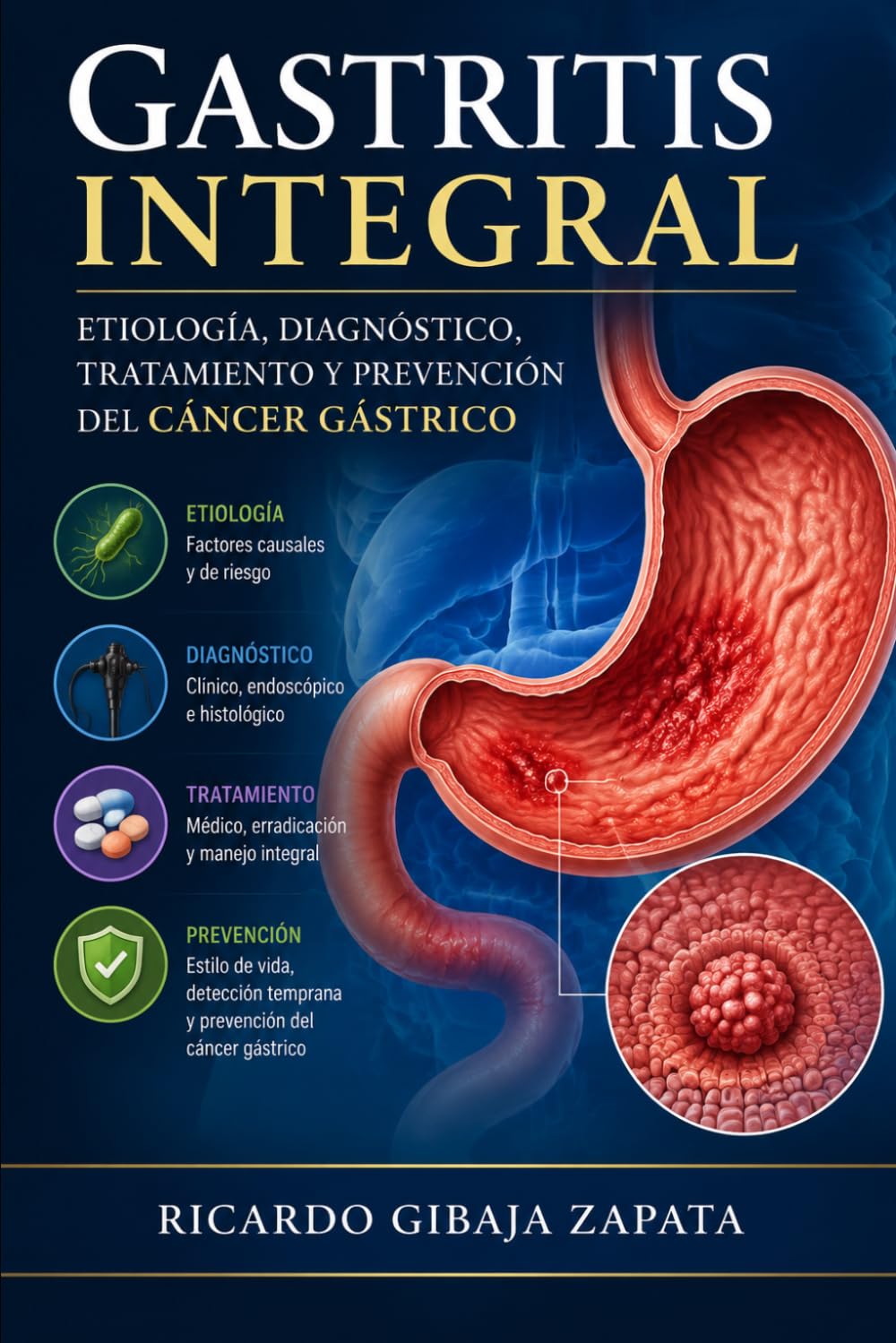 Gastritis Integral: Etiología, Diagnóstico, Tratamiento y Prevención del Cáncer Gástrico