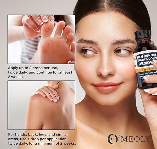 Miniatura 4 de Removedor de verrugas de piel de veneno de abeja removedor de verrugas cutáneas de ácido salicílico de acción rápida al 20% para verrugas plantares,