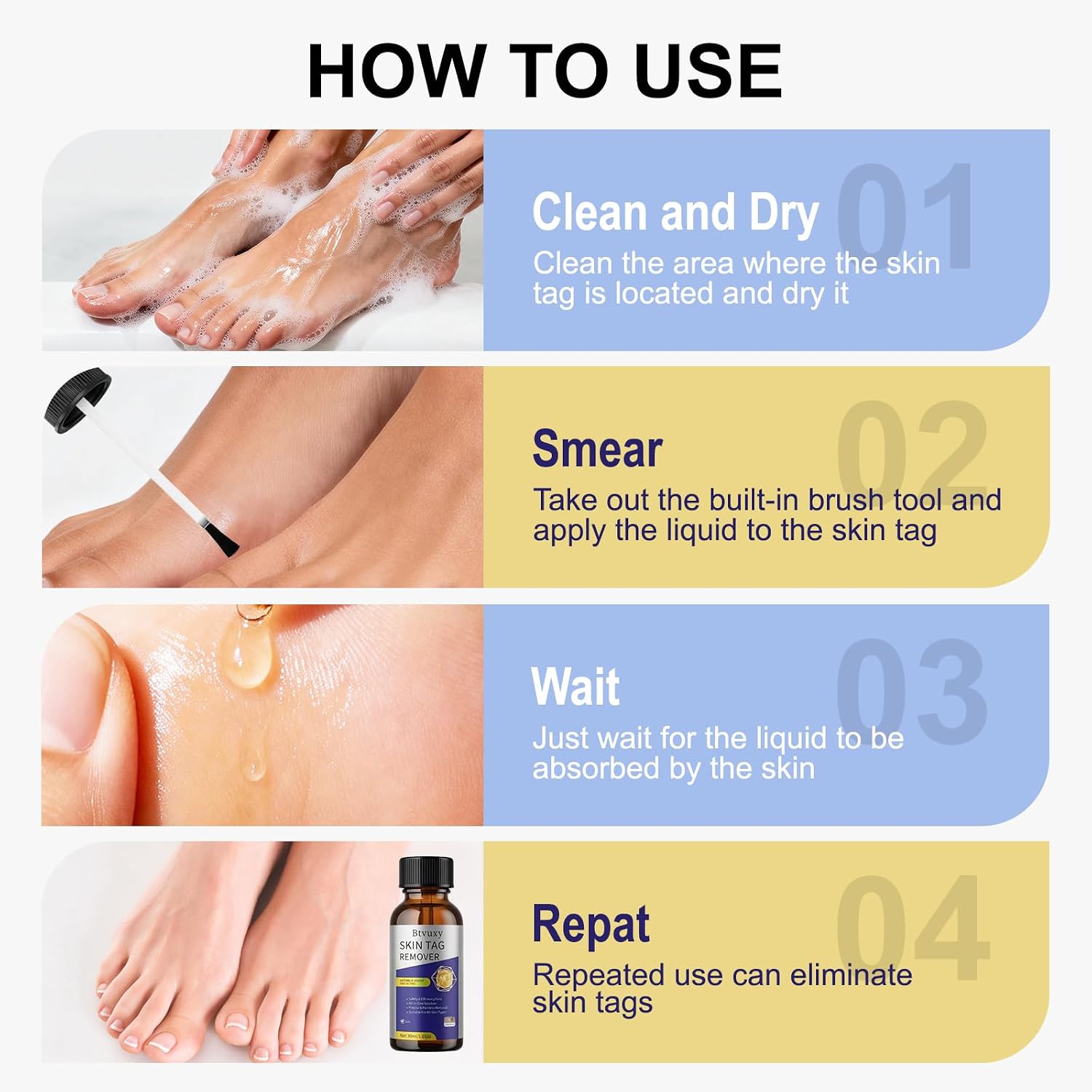 Fast-Acting Skin Tag Remover with Salicylic Acid, With a Precision Brush, Natural & Advanced Formula, Mild & non irritating, Suitable for All Skin Types,Efficiently & Painless Remover Tags, 30ml