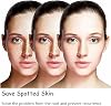 Aobenz Whitening and Freckle Removing Essence (3Pcs)