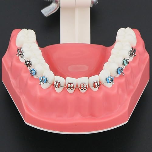 Miniatura 6 de Modelo de Ortodoncia Dental Modelo de Tratamiento de Dientes con Soporte de Metal Arcos Tubos Ligadura Lazos para Enseñar Estudiar Tamaño Estándar