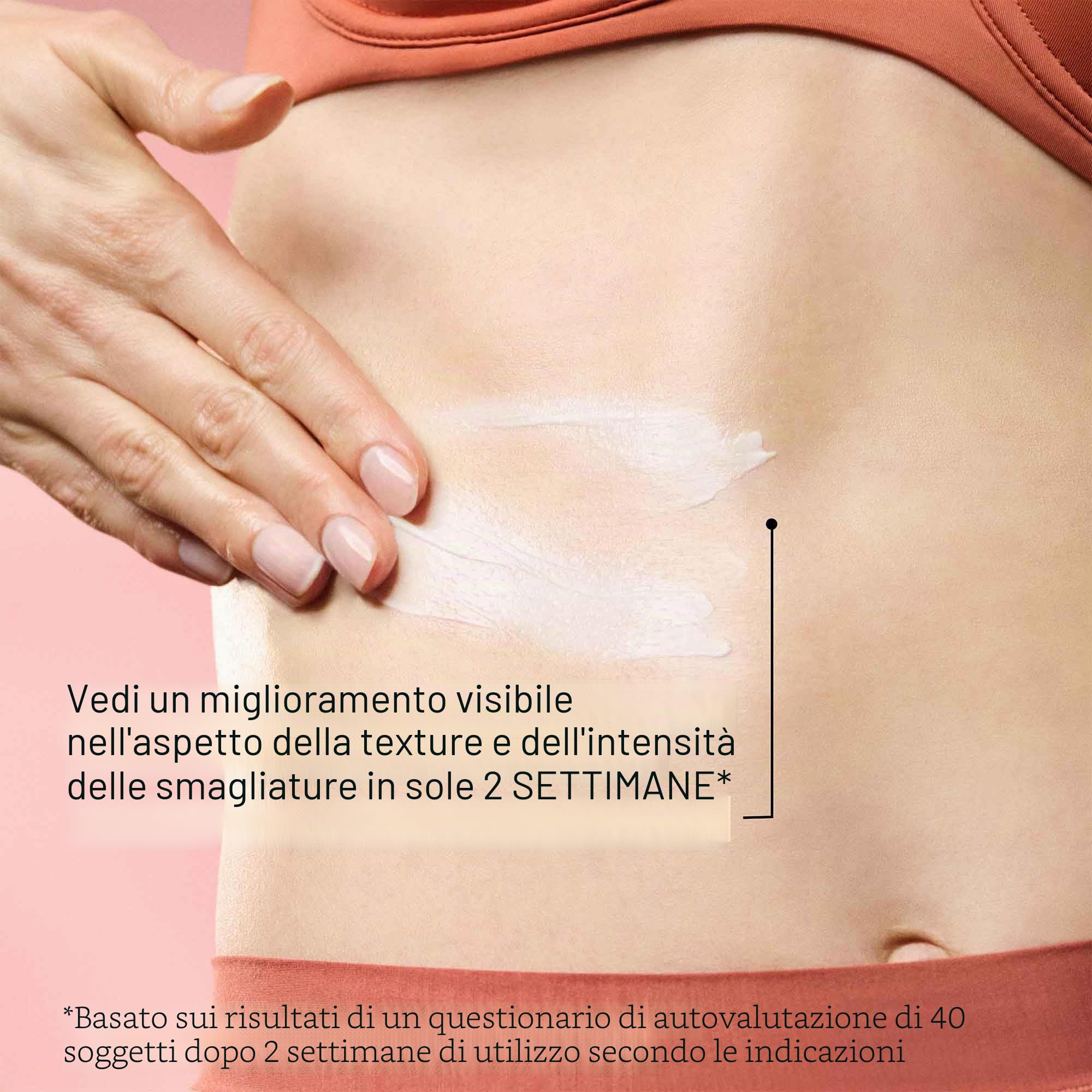 StriVectin SD Advanced™ Plus Crema idratante intensiva per rughe e smagliature, per viso e corpo, potenziamento del collagene con peptidi e acido ialuronico
