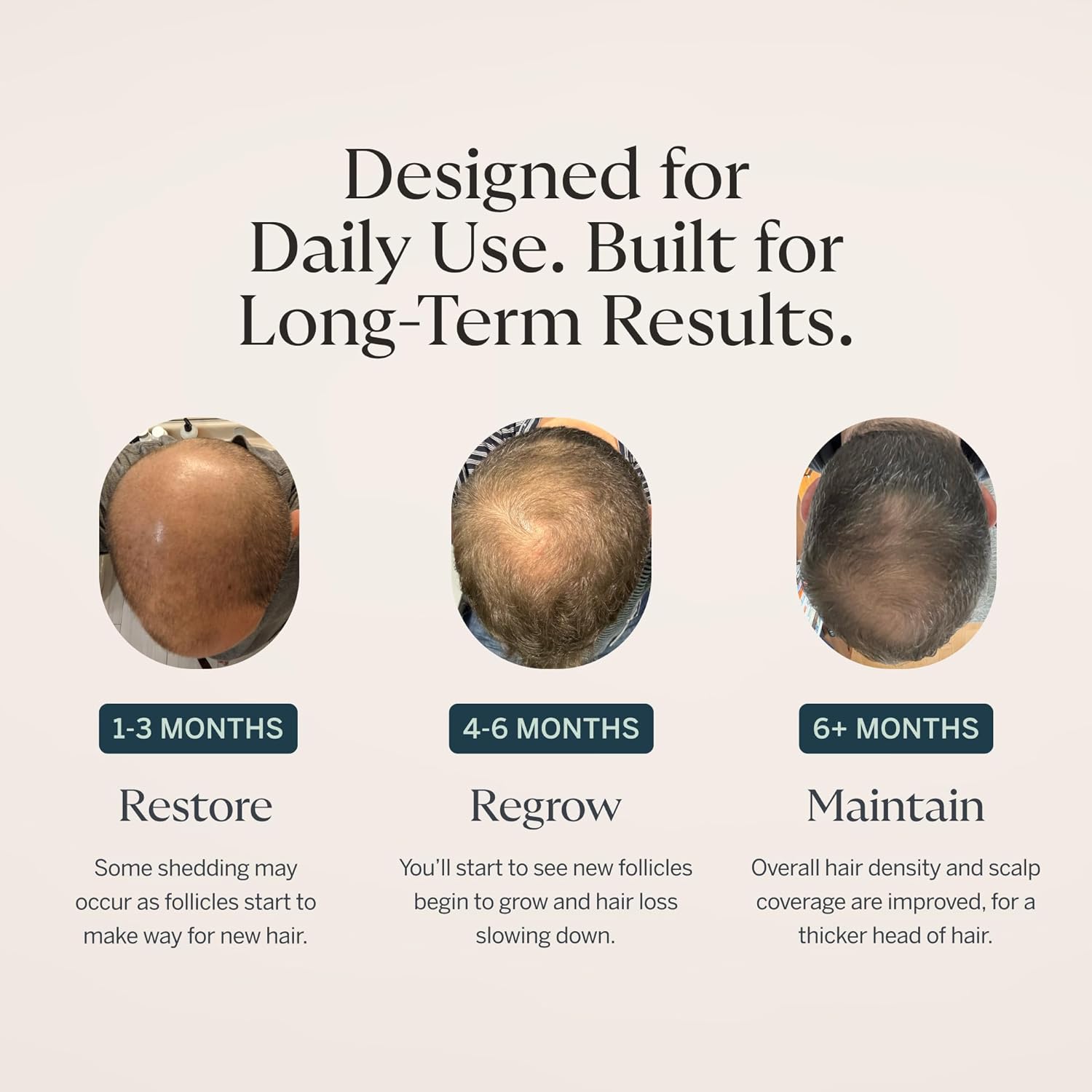 Happy Head Dermaroller for Scalp, Beard and Face – 0.25mm Microneedling Tool to Help Scalp Stimulation, Refine – Skin Care and Grooming for Men and Women