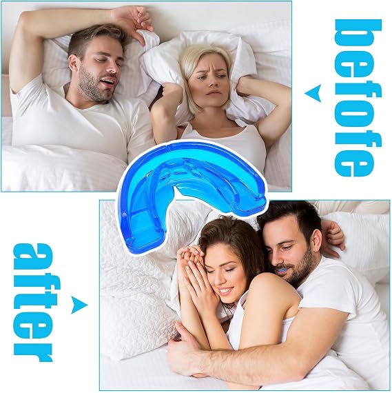 2 Pcs Anti Snoring Devices for Sleep, Adjustable Snoring Mouthpiece-Ready to Use Snore Stopper-Comfortable, Anti Snore Mouthpiece Device Sleeping Snore Stopper Fit for Men and Women(Blue)