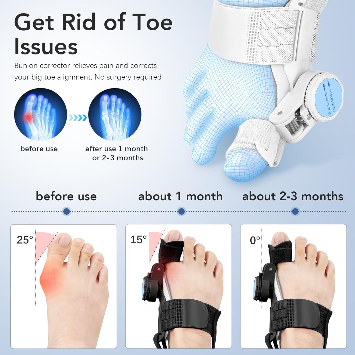 Bunion Corrector for Women Men: Big Toe Straightener Bunion Fix with Adjustable Knob-Orthopedic Bunions Splint Brace Toe Alignment Correction for Hallux Valgus Pain Relief Day/Night (Black) - Image 2