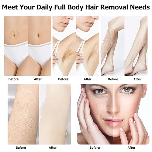 Miniatura 63 de Kit de cera nasal de CoFashion - 1.76 oz de cera para depilación, 20 aplicadores (hasta 20 usos), 10 vasos de papel para depilación de nariz y orejas