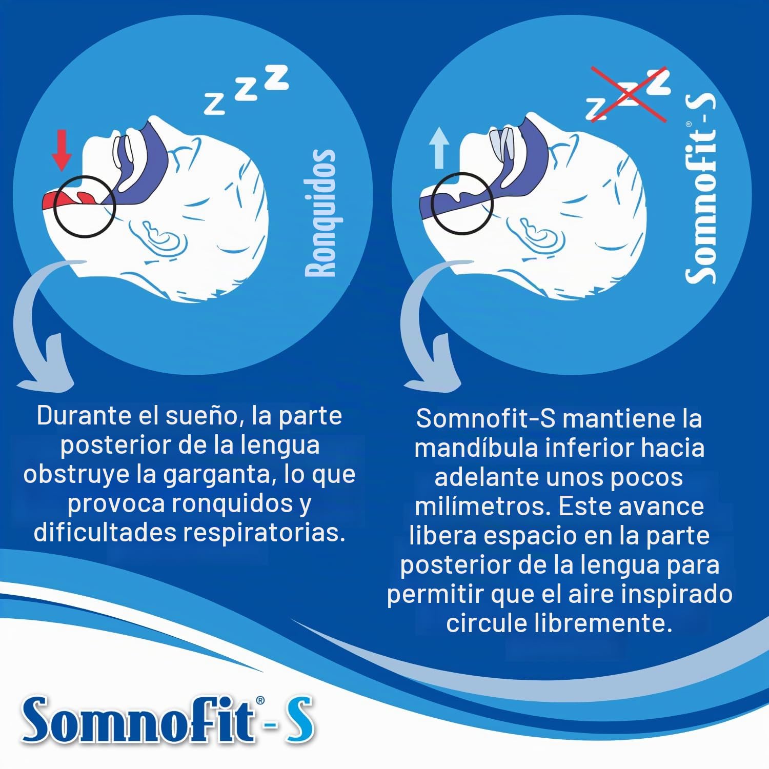 Somnofit-S – Ortesis antironquidos – Canal dental flexible y termoformable – Diseño patentado, gran comodidad – Ortesis mandibular fabricada en Suiza