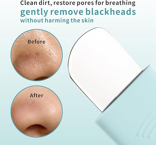 Miniatura 4 de Limpiador facial de silicona con herramienta para quitar puntos negros, para limpieza profunda de poros y exfoliantes, espátula, limpiador de poros,