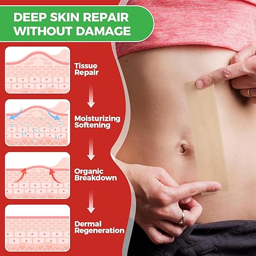 Miniatura 4 de Hojas de silicona para cicatrices, rollo de cinta de silicona para cicatrices (rollo de 1.6 x 60 pulgadas - 4.9 ft), tiras de cicatriz de silicona