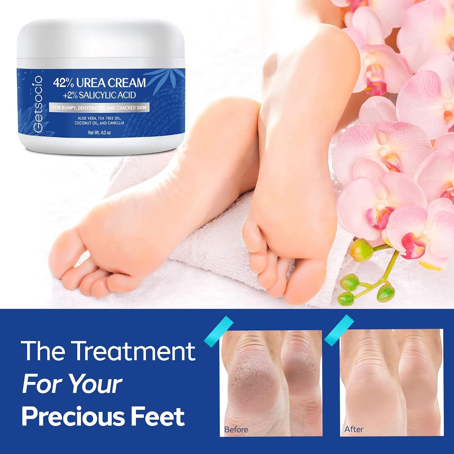 Urea Cream 42% Plus Salicylic Acid 4 Oz, Upgraded Callus Remover Hand Cream Foot Cream for Dry Cracked Feet, Hands, Heels, Elbows, Knees, Intensive Moisturizes & Softens Skin, Exfoliates Dead Skin : Everything Else