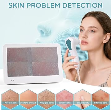 Scalp Camera with 12 Inch HD Screen, Skin Hair Analyzer with 50X/200X Lenses, High-Definition Scalp Analysis Machine, Profesional Skin Diagnosis Machine for Home & Salon Use