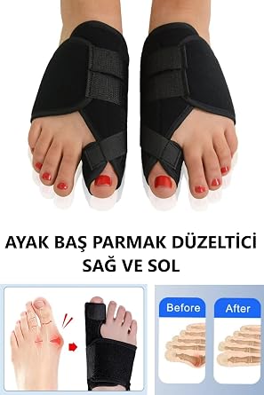Ayak Başparmak Kemiği Çıkıntısı Düzeltici Medikal Halluks Valgus Ayak Sağlığı Sağ-Sol 2 Parça