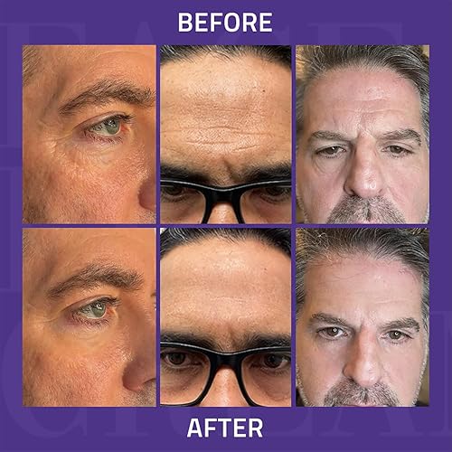 Miniatura 6 de YEOUTH Crema de estiramiento facial instantáneo, crema para apretar temporalmente la piel debajo de los ojos para mujeres, corrector de estiramiento