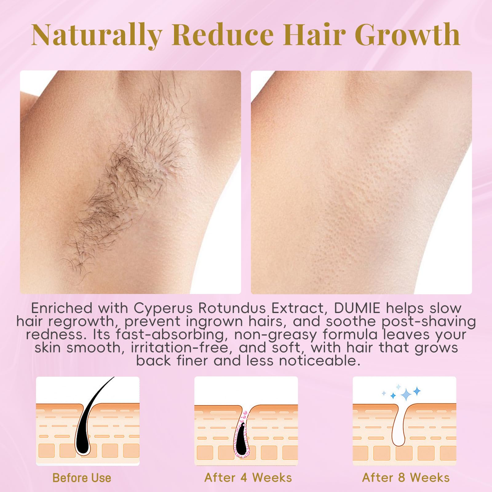 DUMIE Cyperus Rotundus Serum Roll-On for Ingrown Hairs and Razor Bumps, 2.03 Fl Oz
