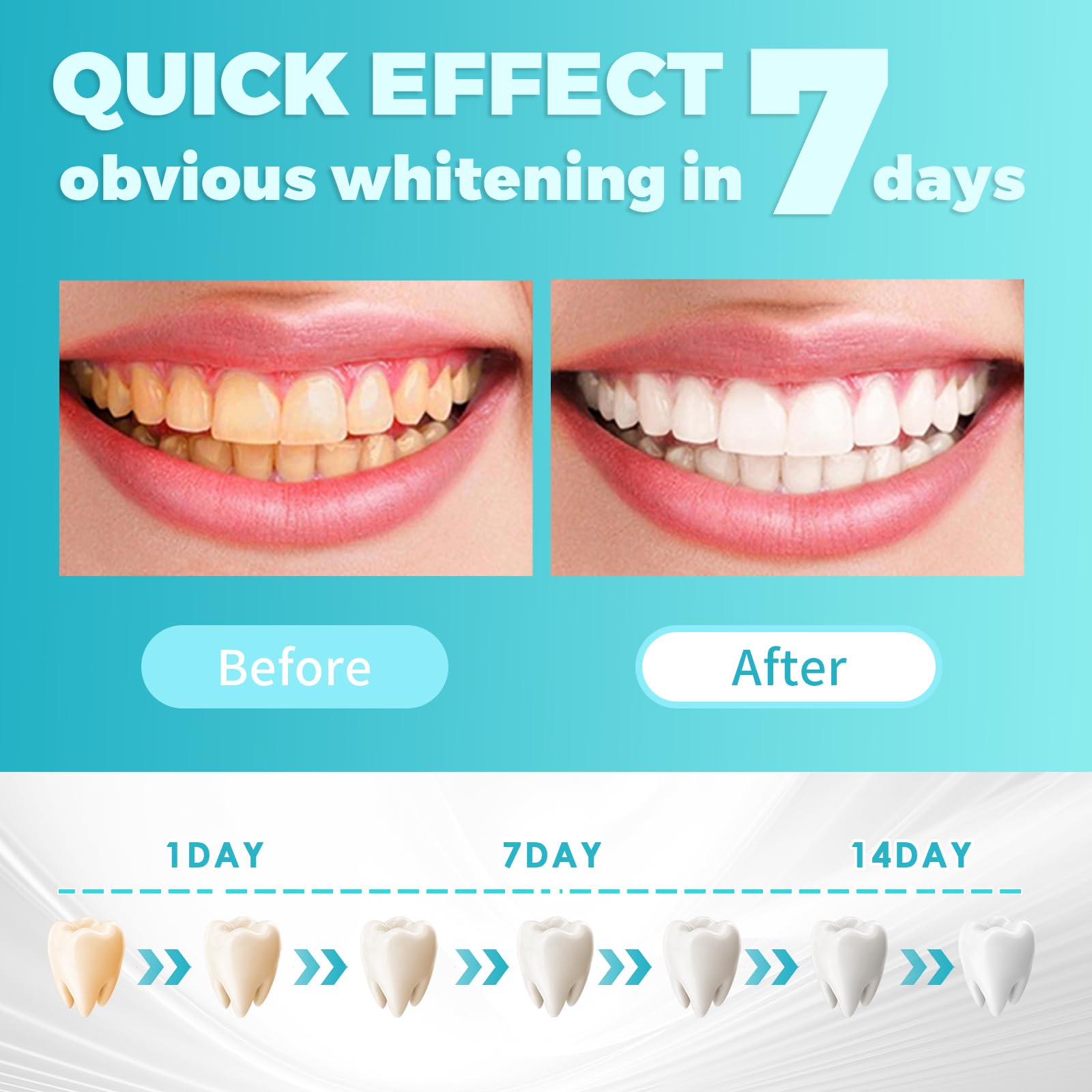 28 Strisce Sbiancanti Denti, Sbiancamento denti professionale, sbiancante denti Rimozione delicata delle macchie dentali, whitening strips Rimuove le Macchie Profonde Sicuro per Denti Smalto