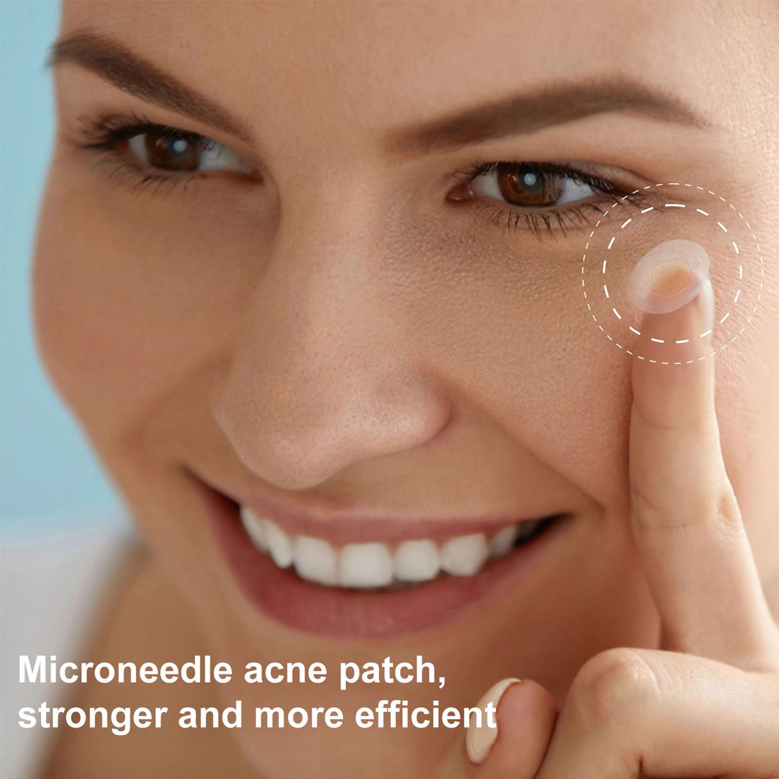 Shefave Pimple Parches Micro Needle, parche hidrocoloide, parches para microagujas para eliminar el acné rápidamente, invisibles y resistentes al agua, parches antiespinillas, día y noche