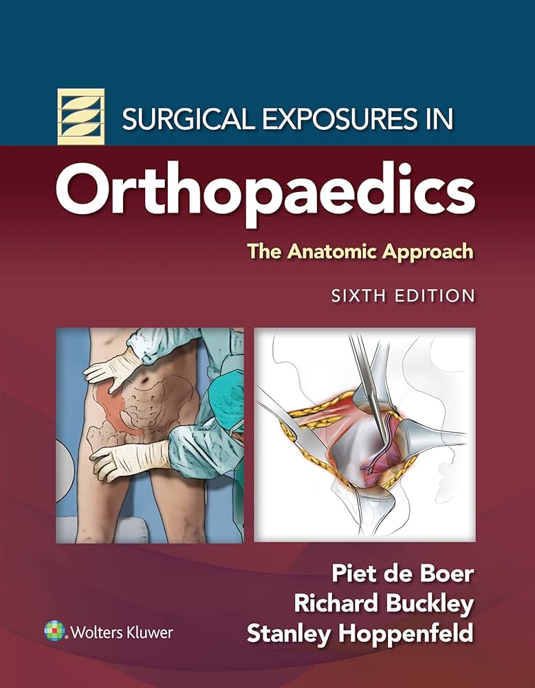 Amazon.com: Surgical Exposures in Orthopaedics: The Anatomic