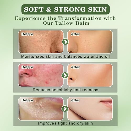 Miniatura 5 de Sarga de ternera y bálsamo de miel para la piel, hidratante totalmente natural que hidrata y nutre la piel, mezcla de sargo de carne alimentada con