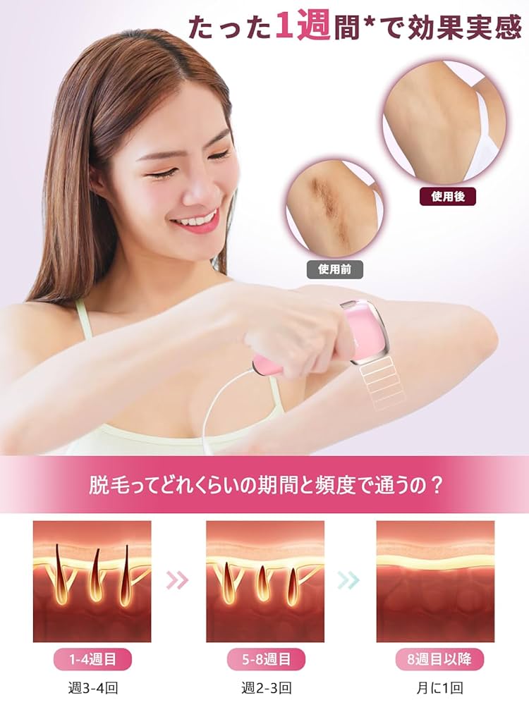 新品　脱毛器 メンズ 髭 脱毛 レディース vio対応 ピンク 光脱毛器 ハイパワー IPL 冷感サファイア VIO対応 男女兼用 家庭